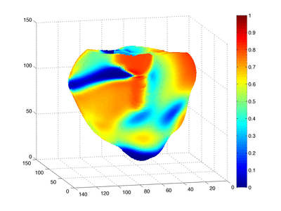 simulation of defibrillation
