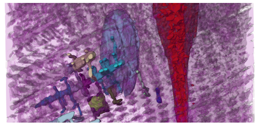 Volumes and Segmentations Extension